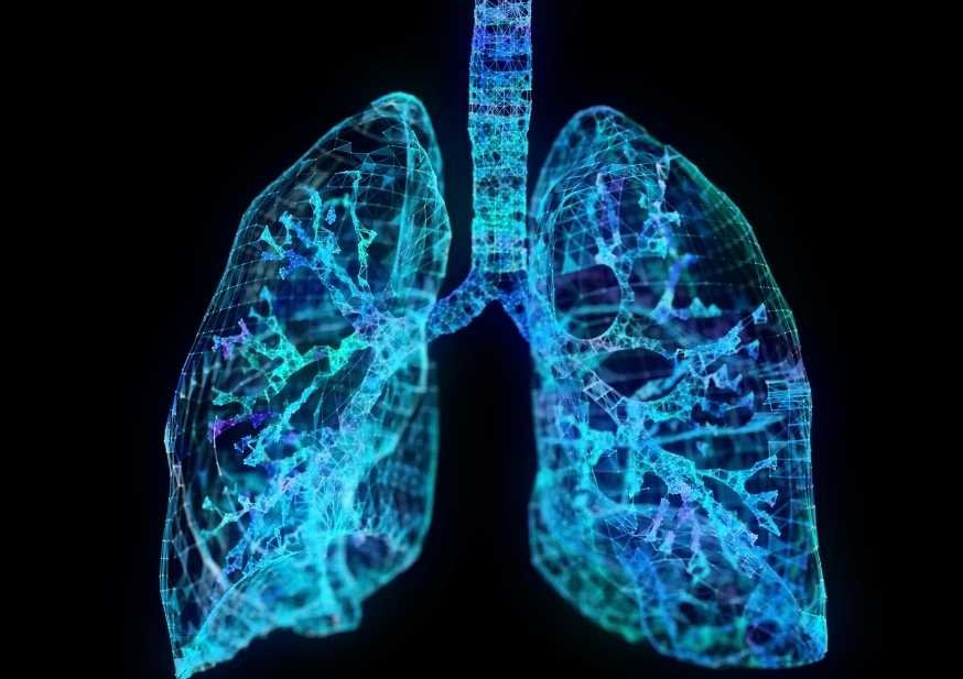 Kas Hastalarında Akciğer Problemleri