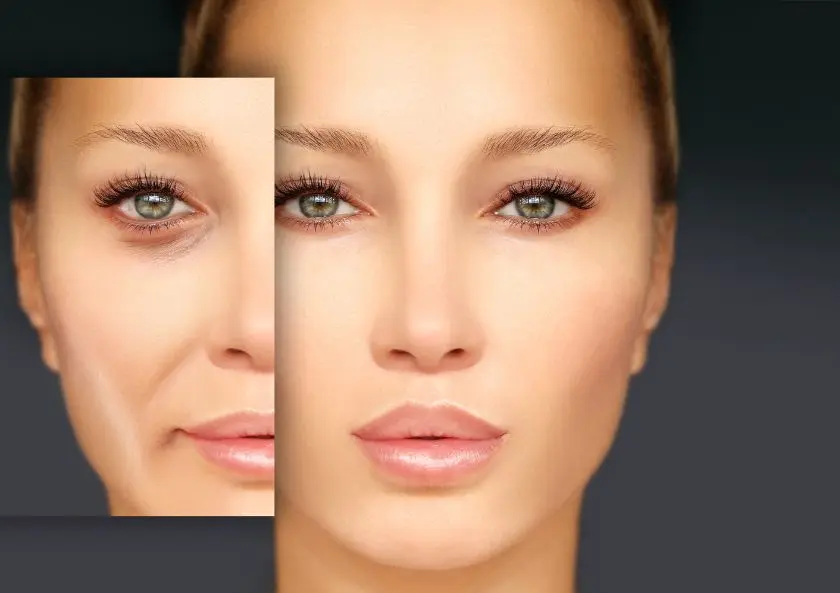 Göz Kapağı Egzaması Neden Olur