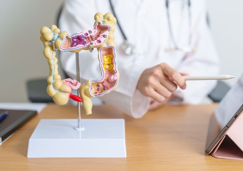 Eozinofilik Kolit Nedir