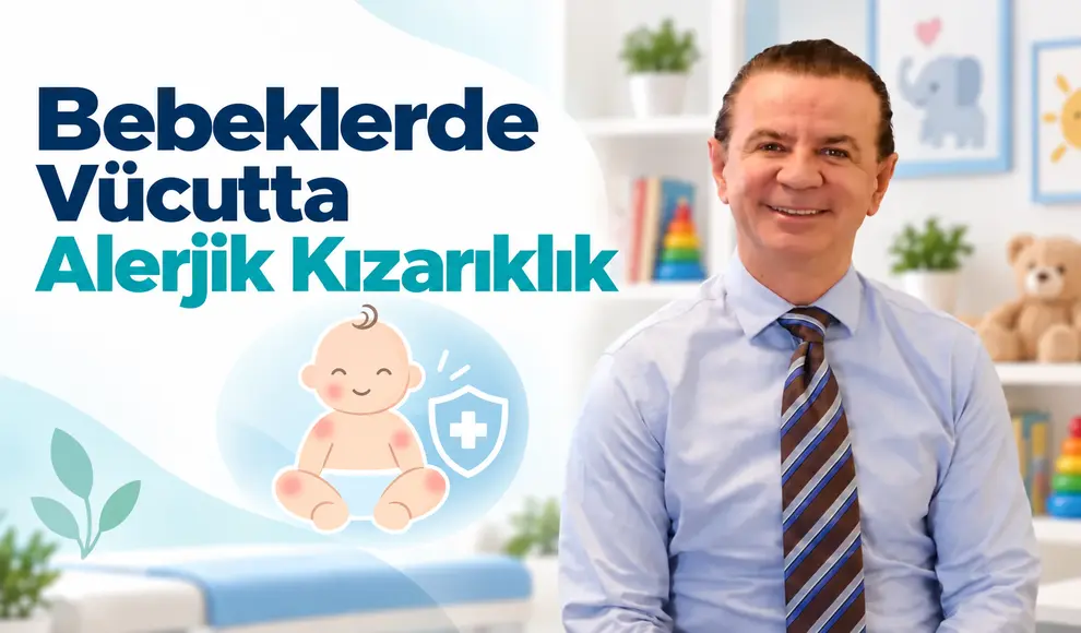 Bebeklerde Vücutta Alerjik Kızarıklık