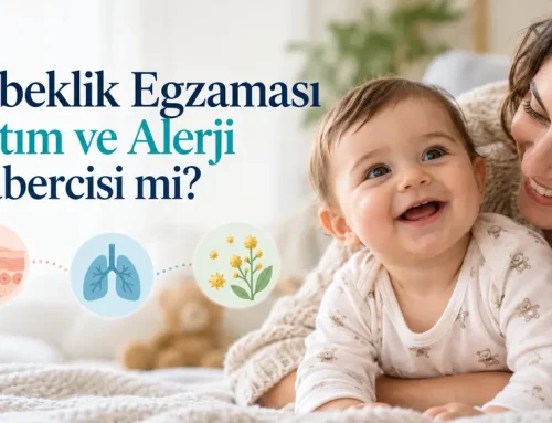 Bebeklik Egzaması Astım ve Alerji Habercisi mi?