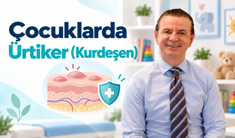 Çocuklarda Ürtiker (Kurdeşen)
