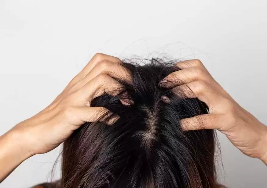 Saç Derisi Kaşıntısının 10 Nedeni
